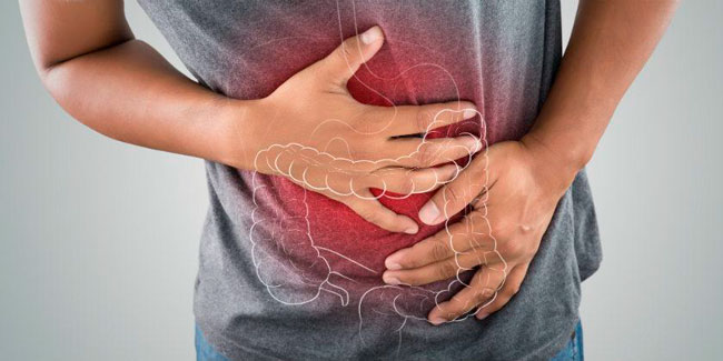 Síndrome de Colon irritable